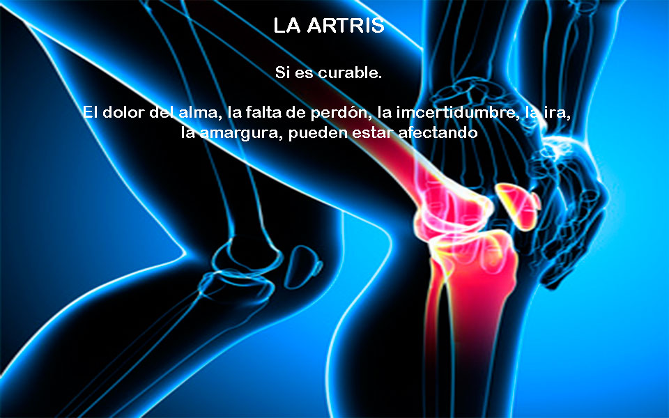 artritis